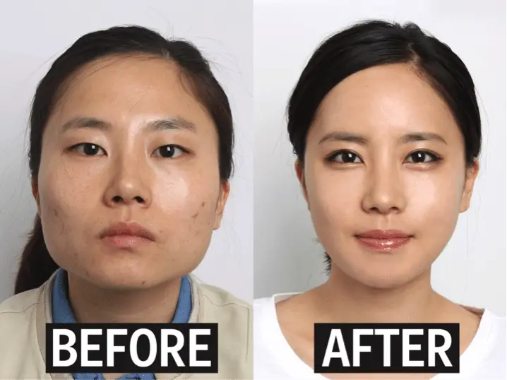 Fun Fact about South Korea 6 Plastic Surgery